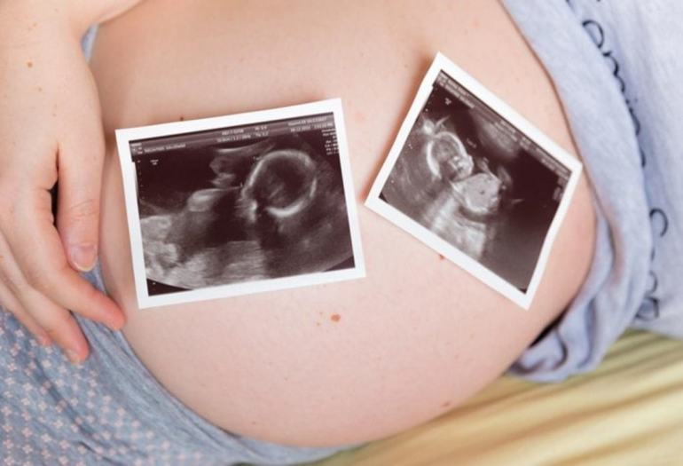 К чему приснилась беременность двойней. К чему снится беременность двойней