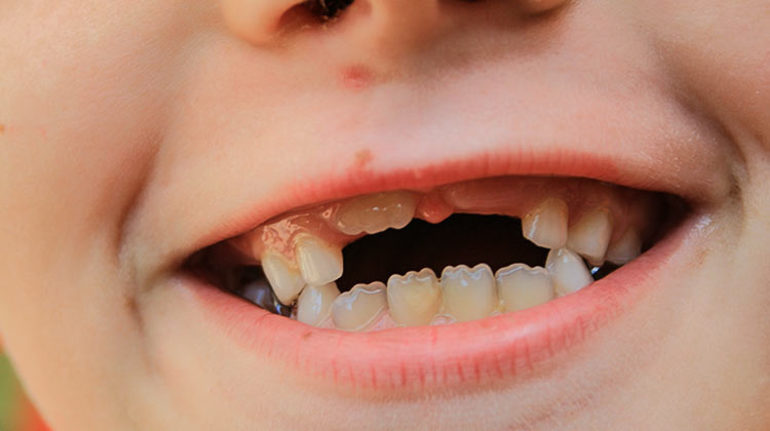 Видеть во сне растут новые зубы. К чему снятся зубы выпадают и растут? К чему снится новый зуб