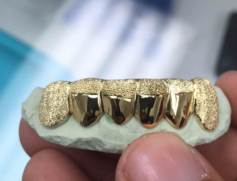 К чему снятся золотые зубы 