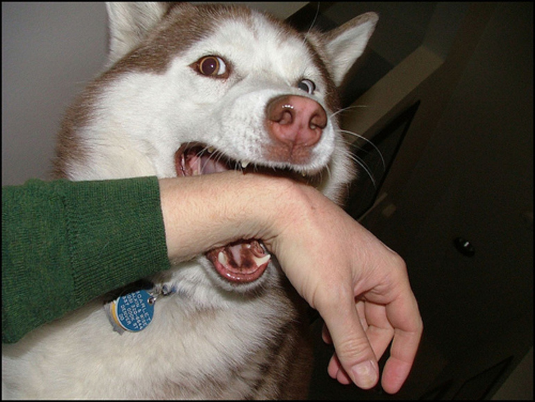 Собака укусила во сне за руку сонник thumbnail