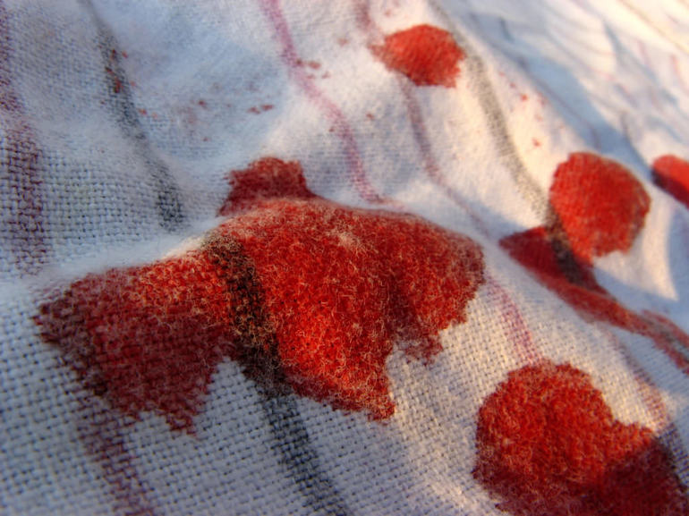 Приснилась кровь на трусах во время беременности thumbnail