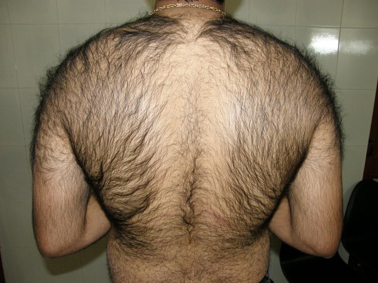 К чему снятся волосы на спине мужчины thumbnail