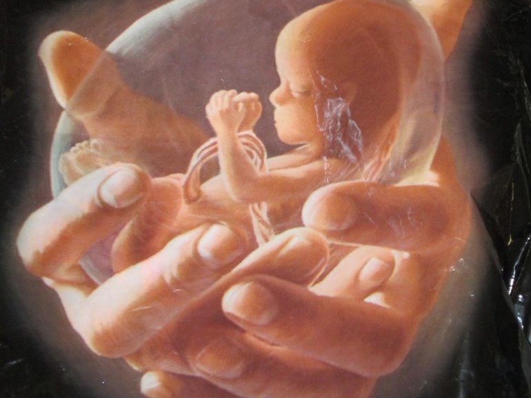 Ночное видение, в котором фигурировал эмбрион