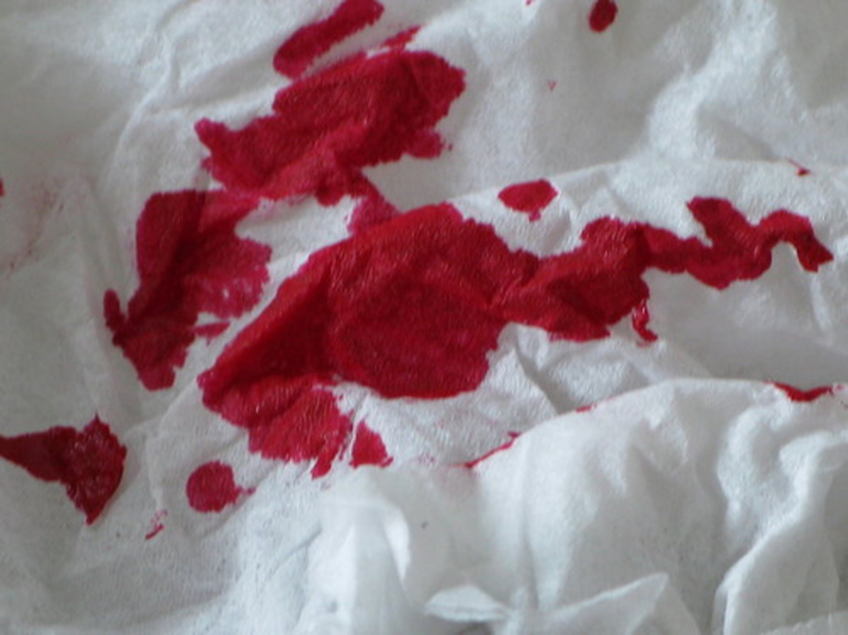 Приснилась менструальная кровь