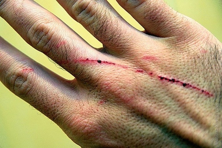 Кошка поцарапала спящему человеку руку, лицо или другую часть тела