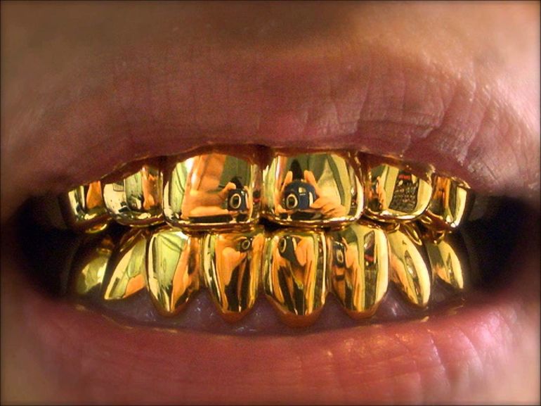 Сонник золотые зубы 