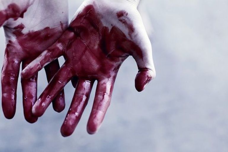 Видеть собственную кровь на руках 